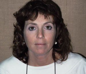 Blepharoplasty Dr. Joel Rein Blepharoplasty Dr. Joel Rein