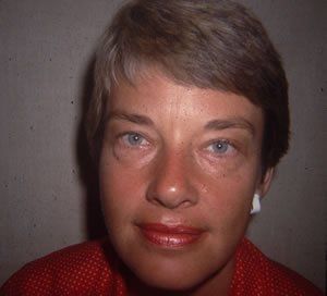 Blepharoplasty Dr. Joel Rein Blepharoplasty Dr. Joel Rein