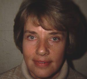 Blepharoplasty Dr. Joel Rein Blepharoplasty Dr. Joel Rein