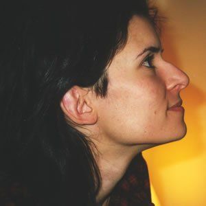 Rhinoplasty Dr. Rein Rhinoplasty Dr. Rein