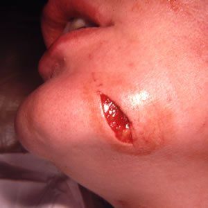 Trauma Injury Dr. Joel Rein Trauma Injury Dr. Joel Rein