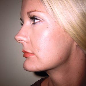 Trauma Injury Dr. Joel Rein Trauma Injury Dr. Joel Rein