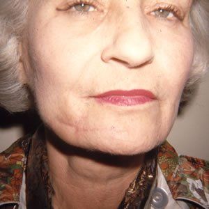 Trauma Injury Dr. Joel Rein Trauma Injury Dr. Joel Rein