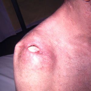 Trauma Injury Dr. Joel Rein Trauma Injury Dr. Joel Rein