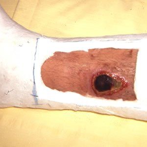 Trauma Injury Dr. Joel Rein Trauma Injury Dr. Joel Rein