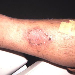 Trauma Injury Dr. Joel Rein Trauma Injury Dr. Joel Rein