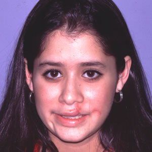 Trauma Injury Dr. Joel Rein Trauma Injury Dr. Joel Rein