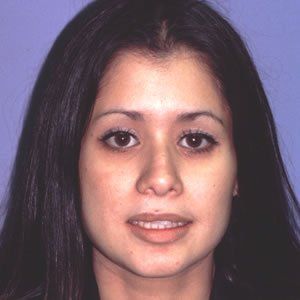 Trauma Injury Dr. Joel Rein Trauma Injury Dr. Joel Rein