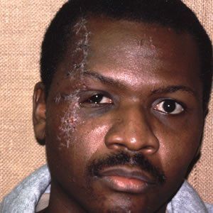 Trauma Injury Dr. Joel Rein Trauma Injury Dr. Joel Rein