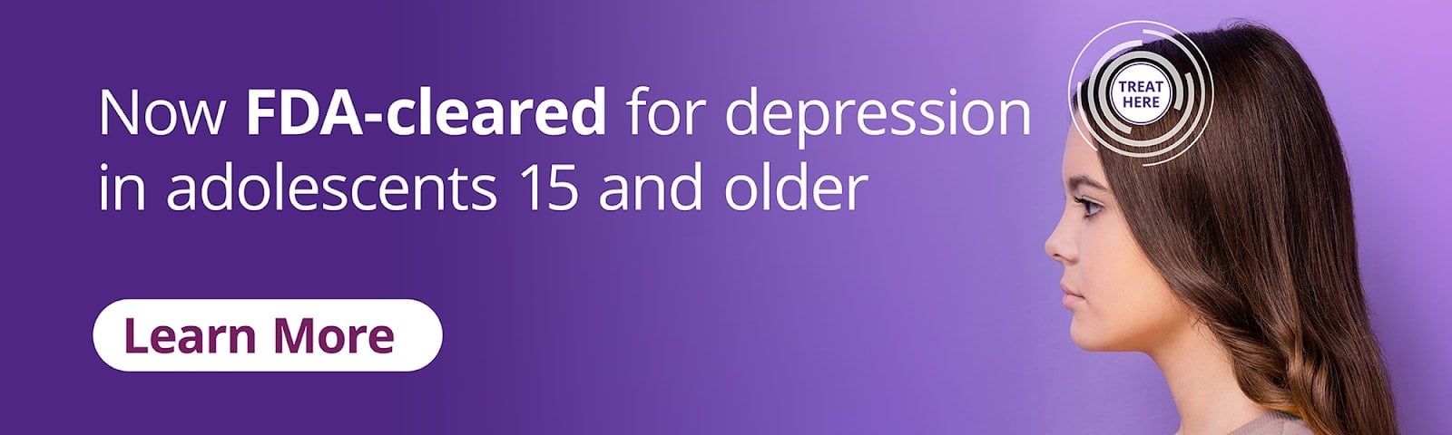 NeuroStar Banner NeuroStar Banner