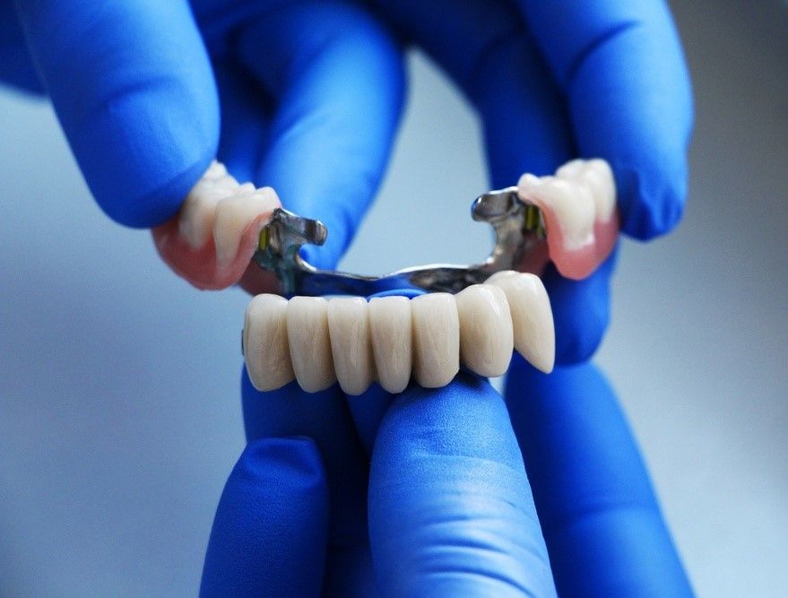 A Person Wearing Blue Gloves is Holding a Dental Bridge — Tweed Banora Dental In Tweed Heads South, NSW