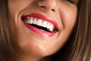 Want a confident Smile?