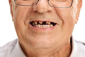 Is your tooth missing?