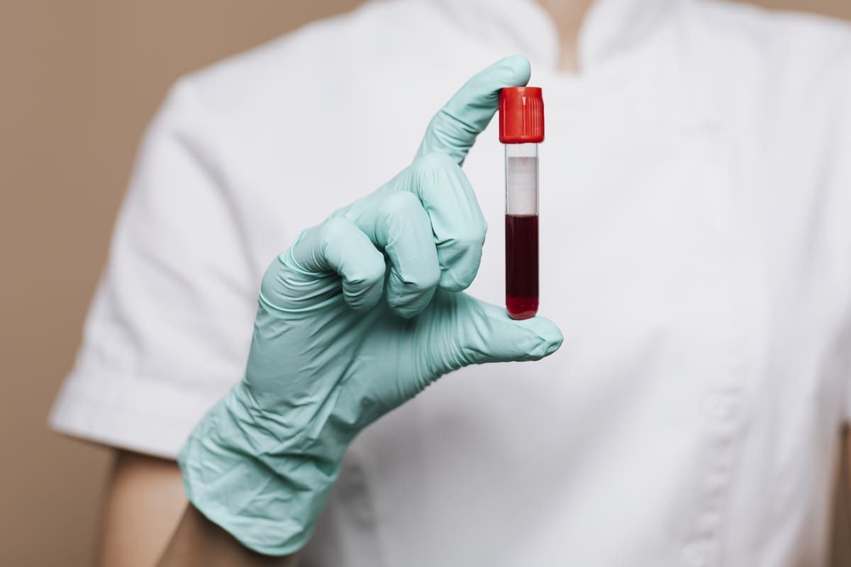 tubo com coleta de exame de sangue para análise de hemograma completo