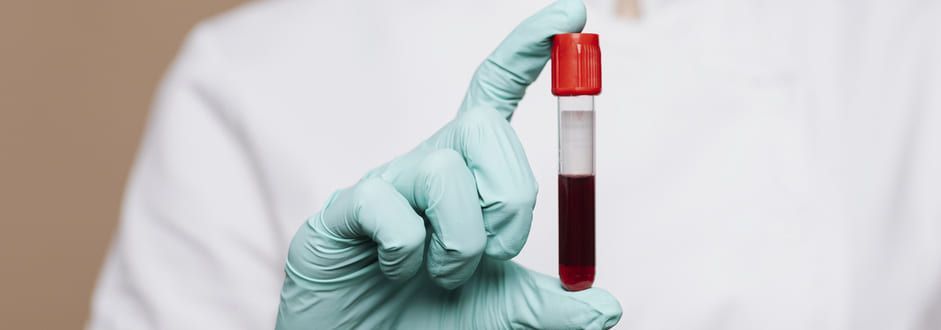 tubo com coleta de exame de sangue para análise de hemograma completo