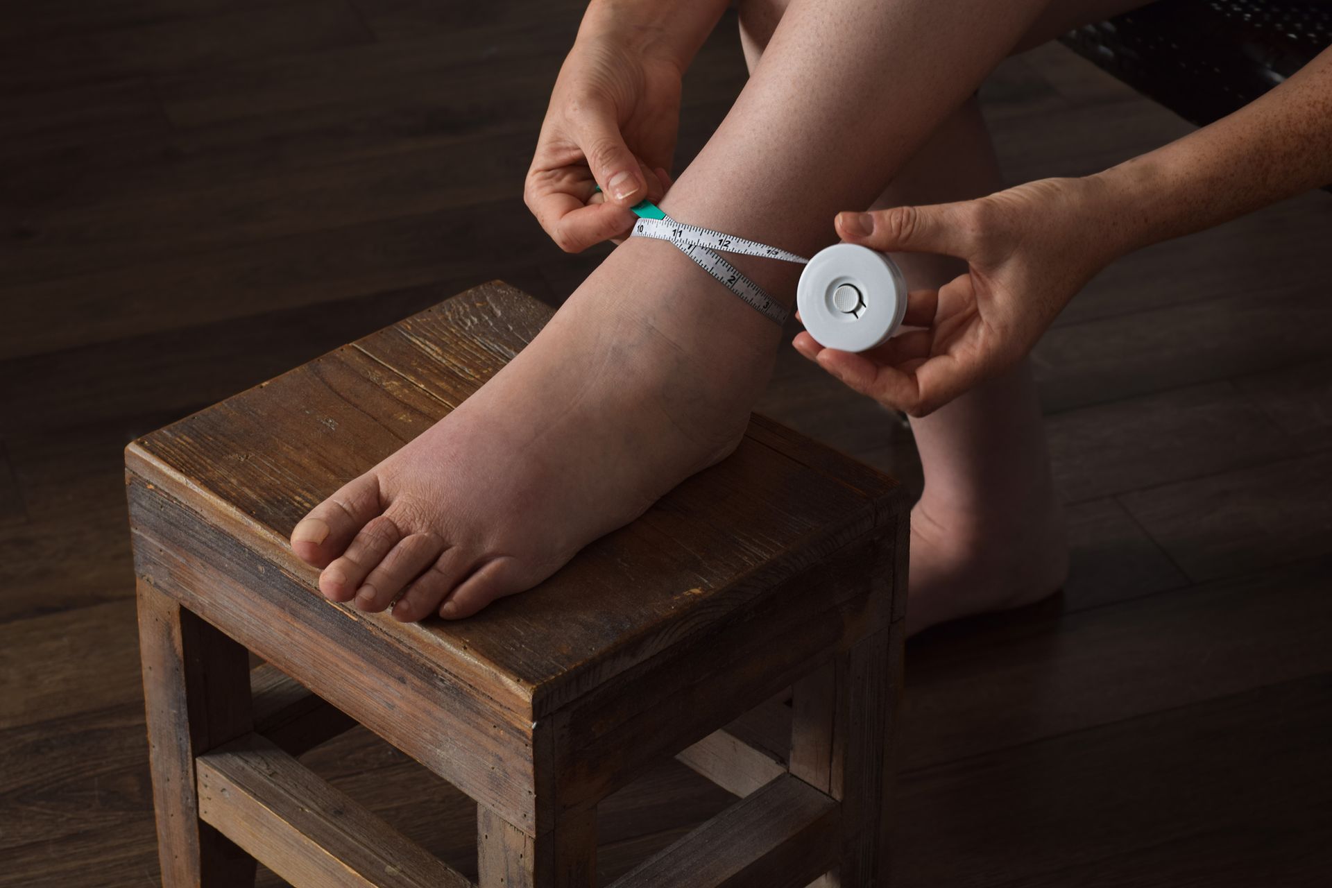 Person measuring swollen ankle with a measuring tape, seated on a wooden stool.