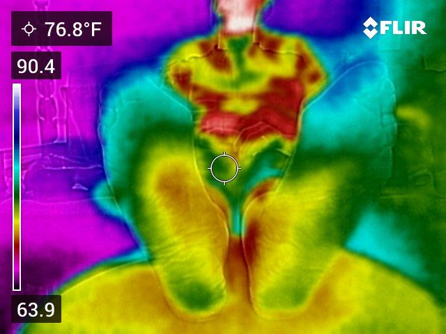 Thermal scans of feet with neuropathy