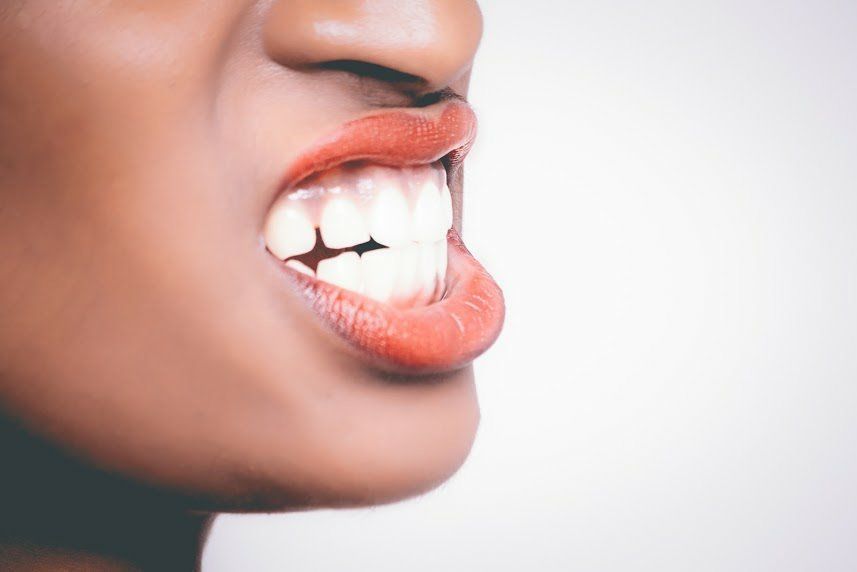 Showing Her White Teeth — Venice, FL — Davis & Beyer DDS PA