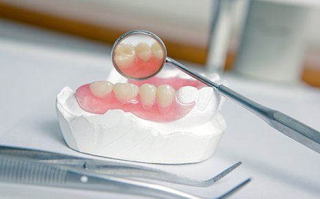 A model of dentures by a professional who does dental implants near South Sarasota, FL
