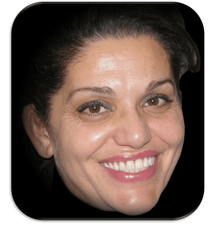 Volto sorridente di donna su sfondo nero, primo piano ritagliato.