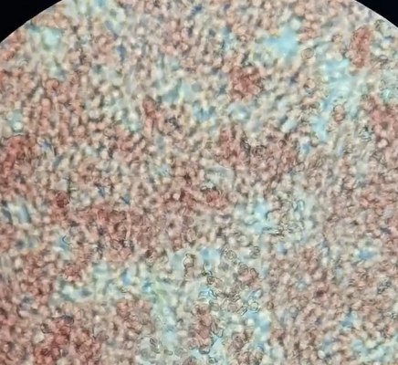 Microscopic View of Numerous Red-stained — Marlin Coast Veterinary Hospital in Trinity Beach, QLD