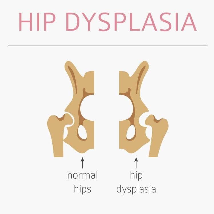 Illustration Comparing Normal Hips to Hip Dysplasia — Marlin Coast Veterinary Hospital in Trinity Beach, QLD