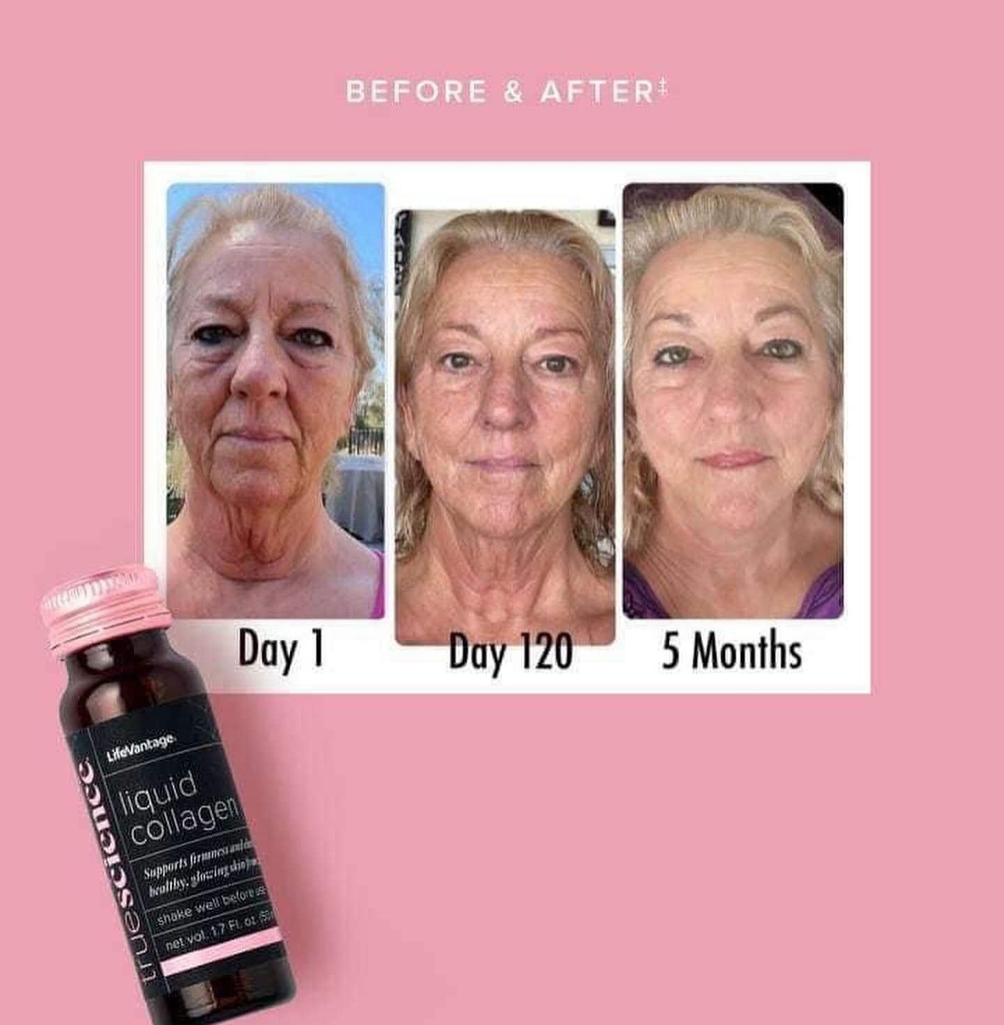 A picture of a woman 's face before and after using liquid collage