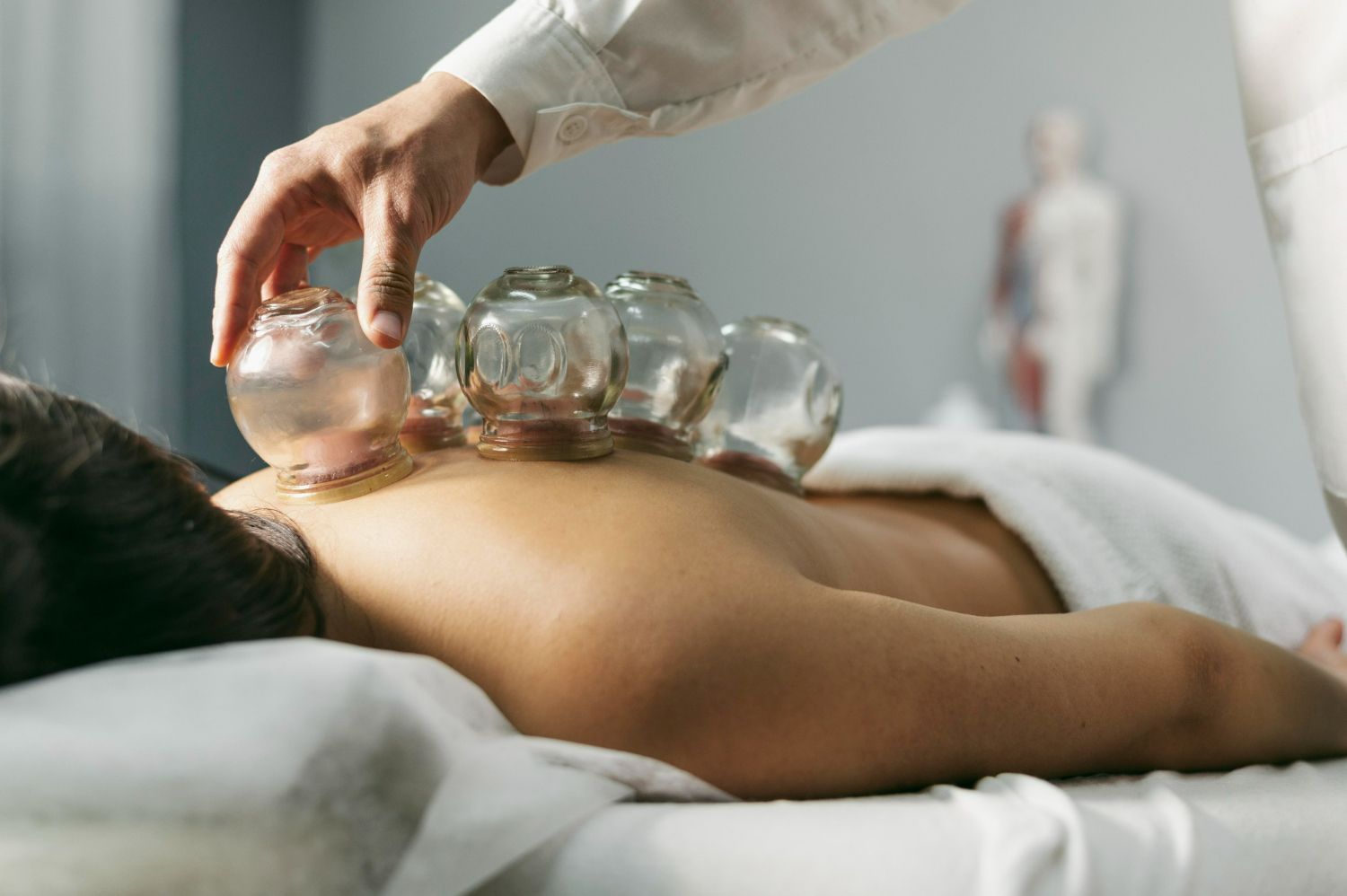 A man is getting a cupping treatment on his back.