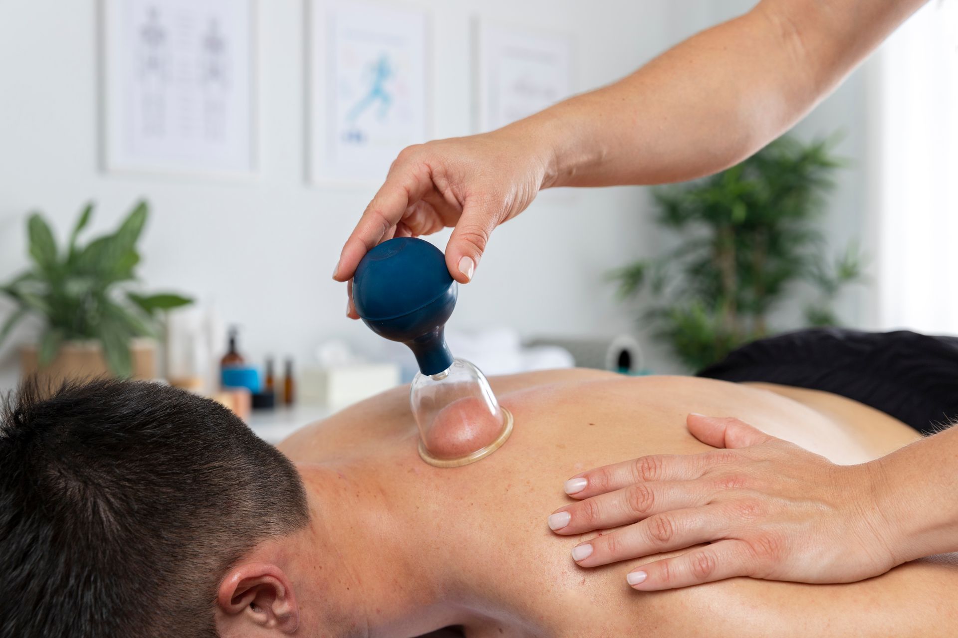 A man is getting a cupping treatment on his back.