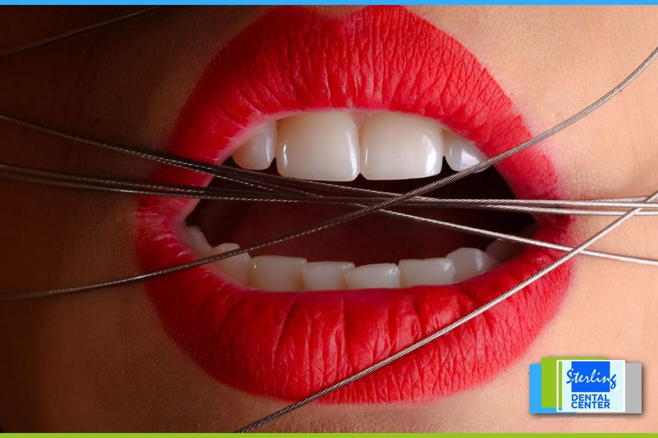 5 Reasons Your Teeth Hurt