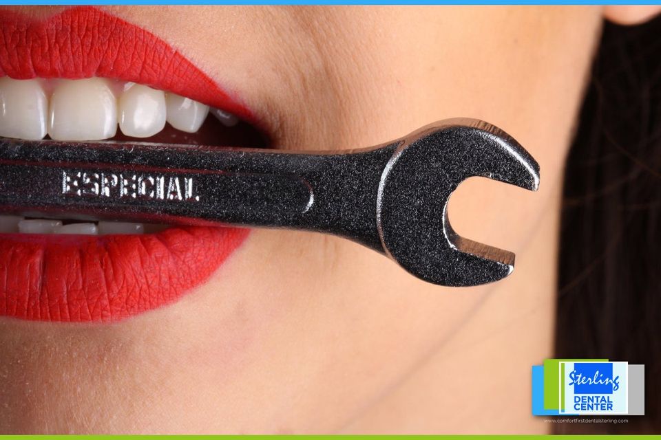 Replace Missing Tooth