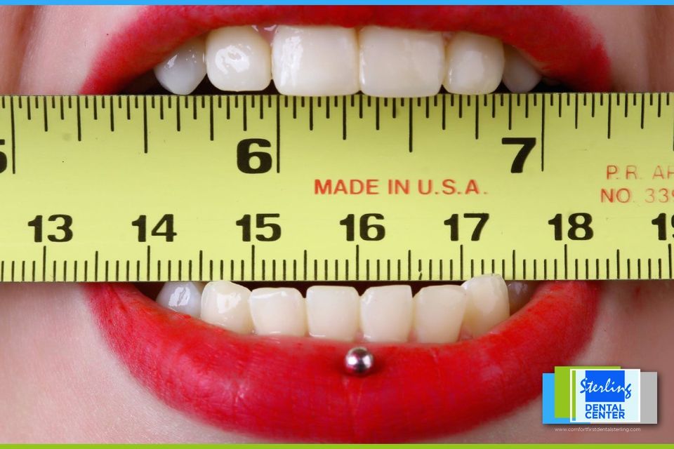 removeable dentures