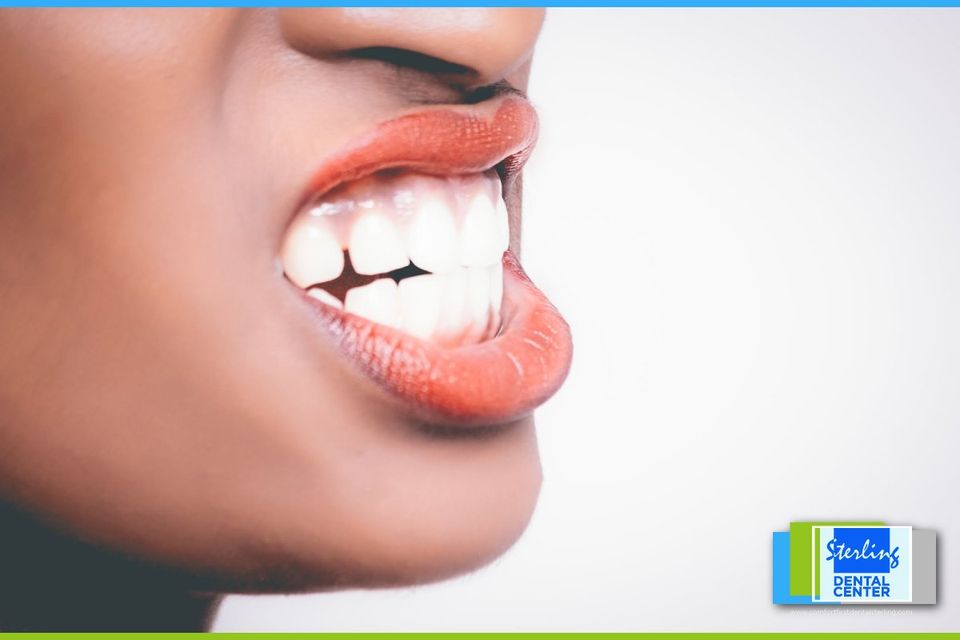 whiten teeth