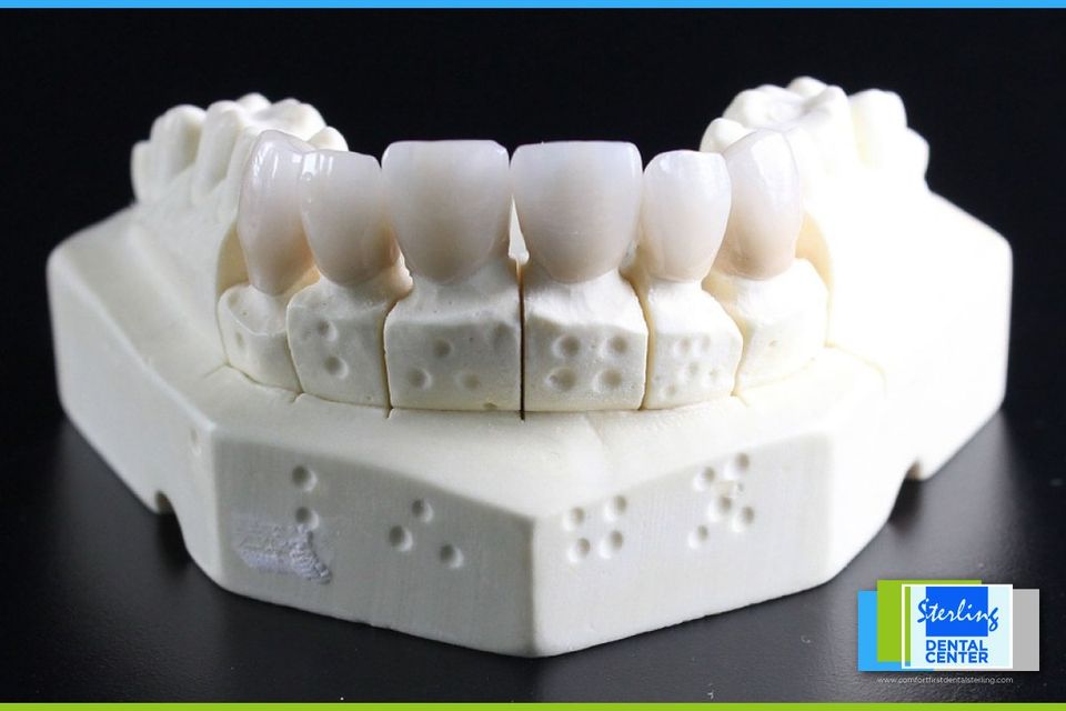 root canal