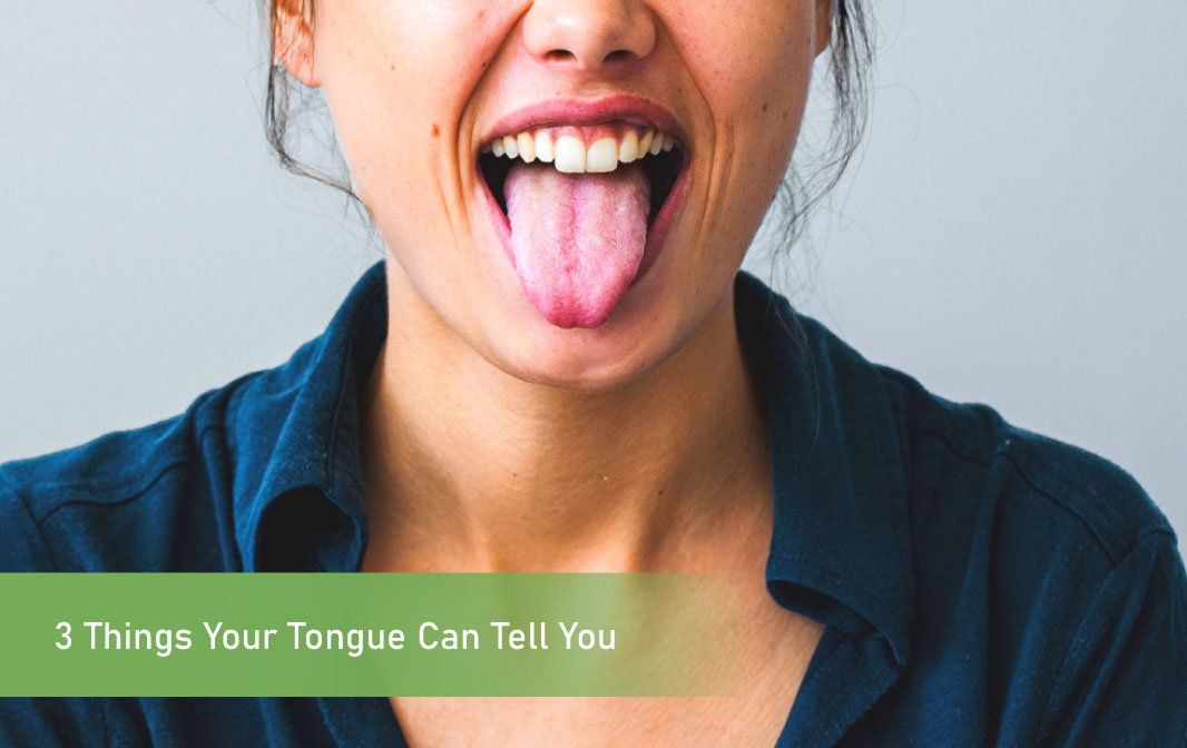 3 Things Your Tongue Can Tell You