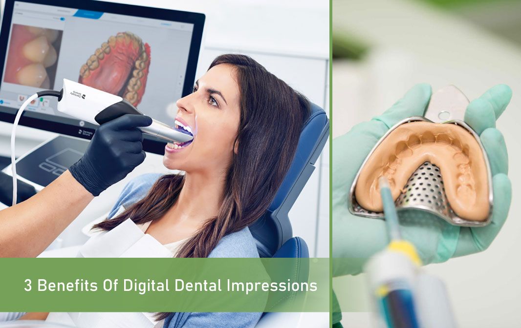 3 Benefits of Digital Dental Impressions