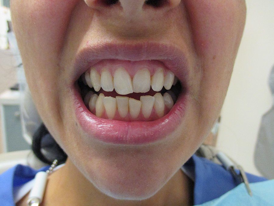 woman smile before 2