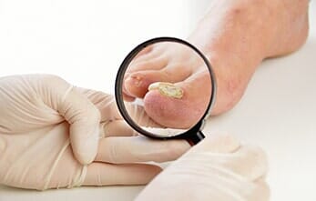 Podologist Checking the Patient — Podiatry Clinic in Eugene, OR