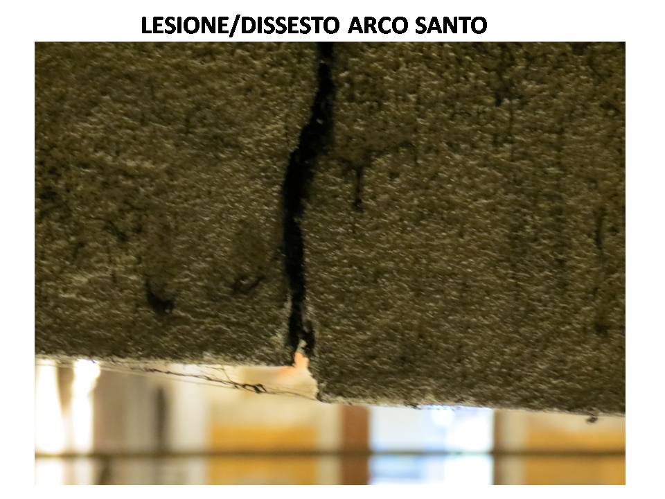 lesion of the holy arch