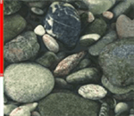 Prosthetic Products — Stones in Dallas, TX