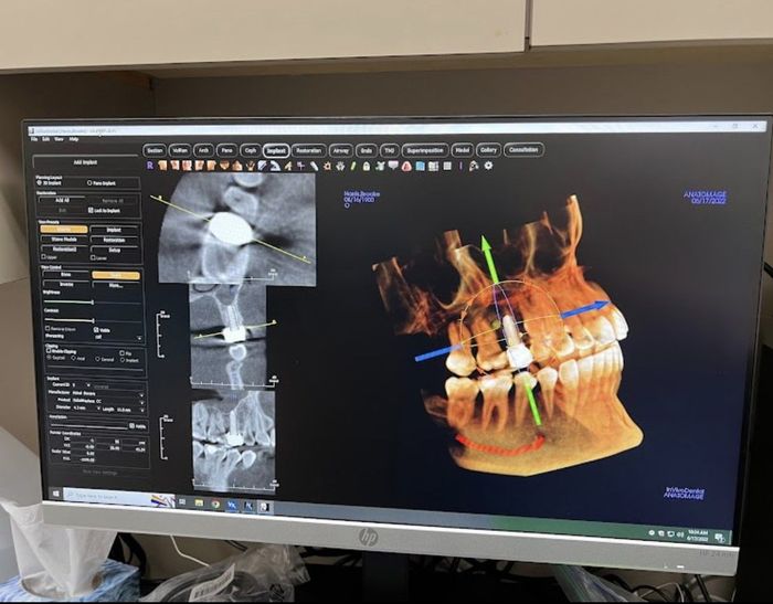 a computer monitor shows a 3d model of a person 's teeth .