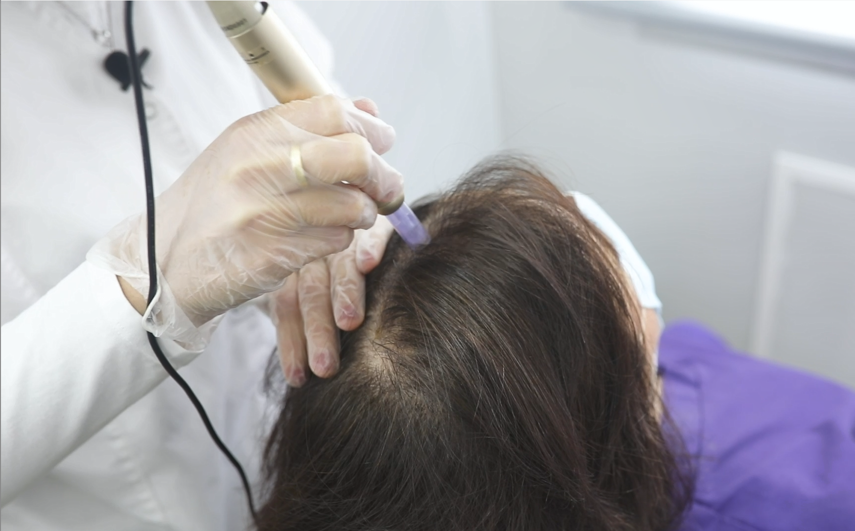 Terapia Capilar - Estimulacion