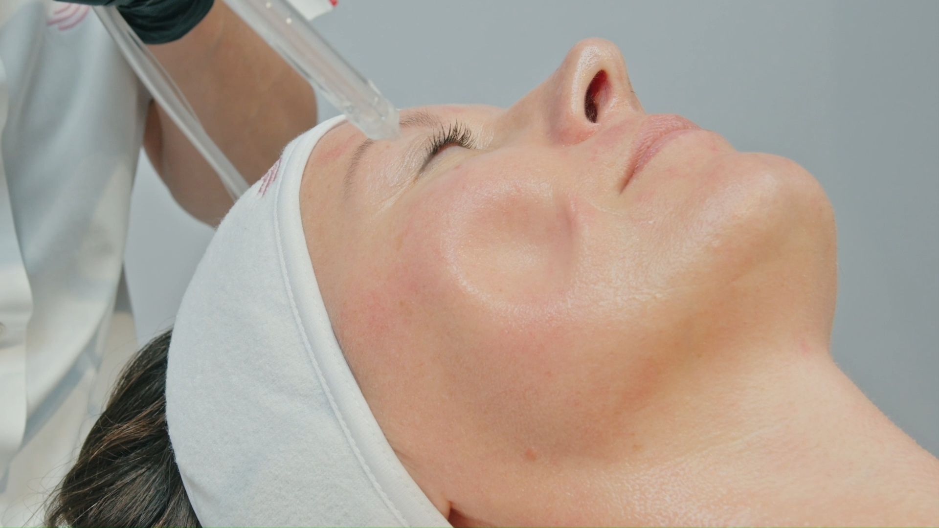 PhotoBiodynamic Therapy Acne Neck