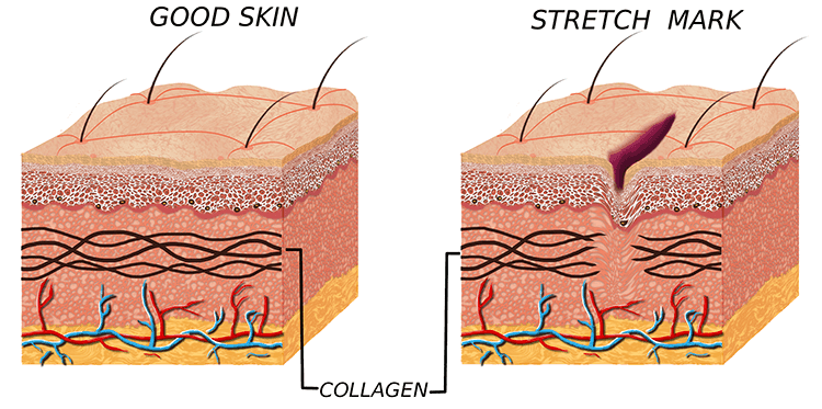 Velvet Skin Facial