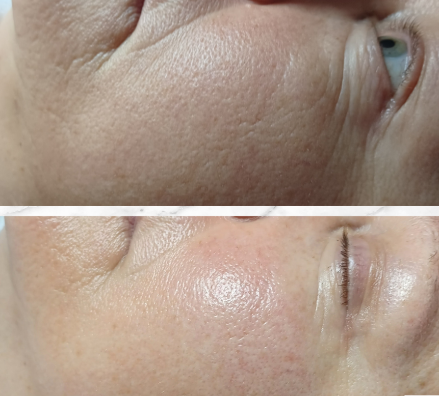 Complete Rejuvenation Before and After 4