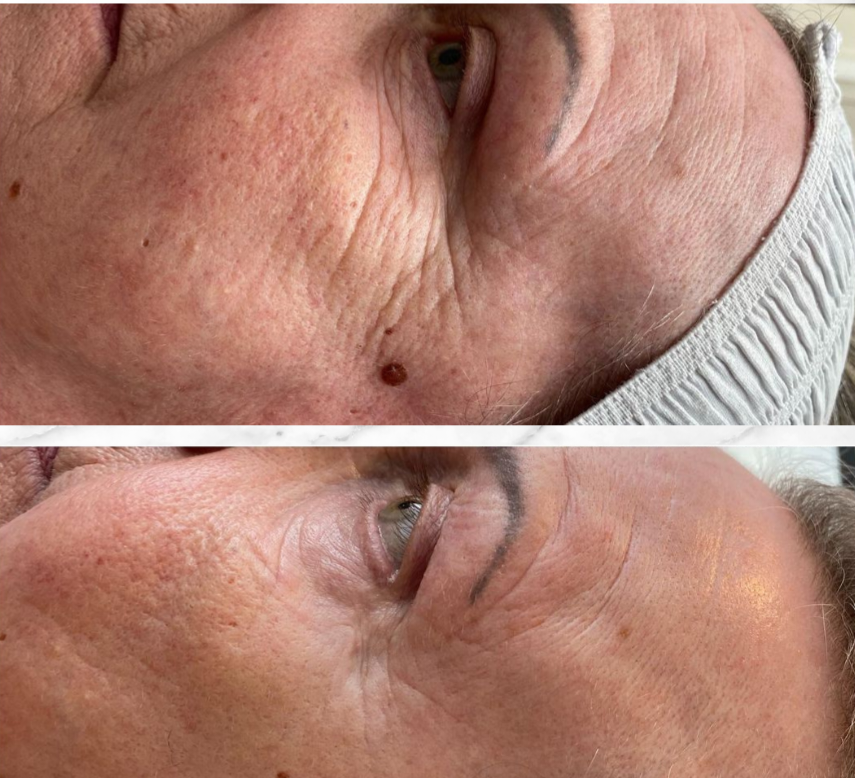 Complete Rejuvenation Before and After 3