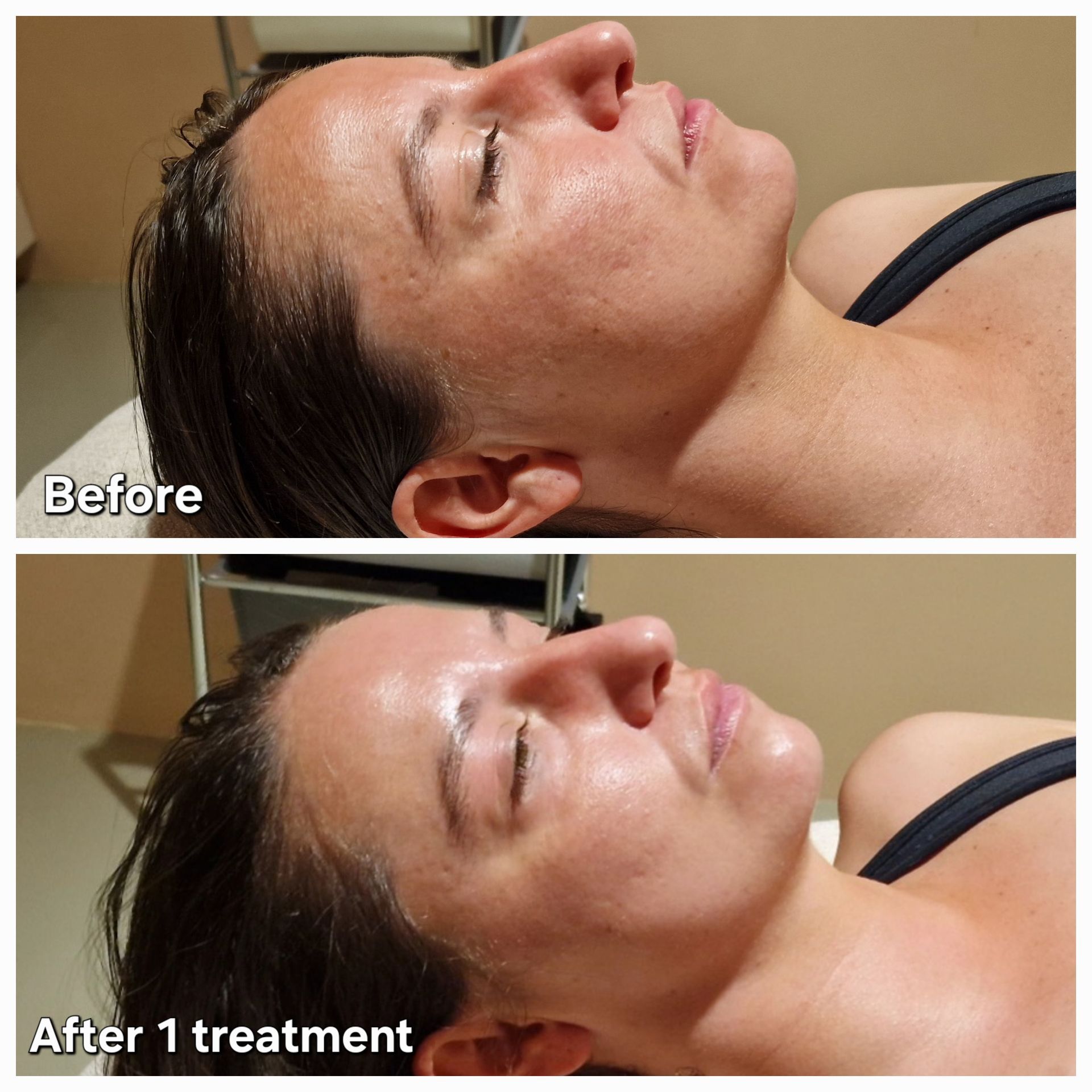 Fire & Ice  Before and After