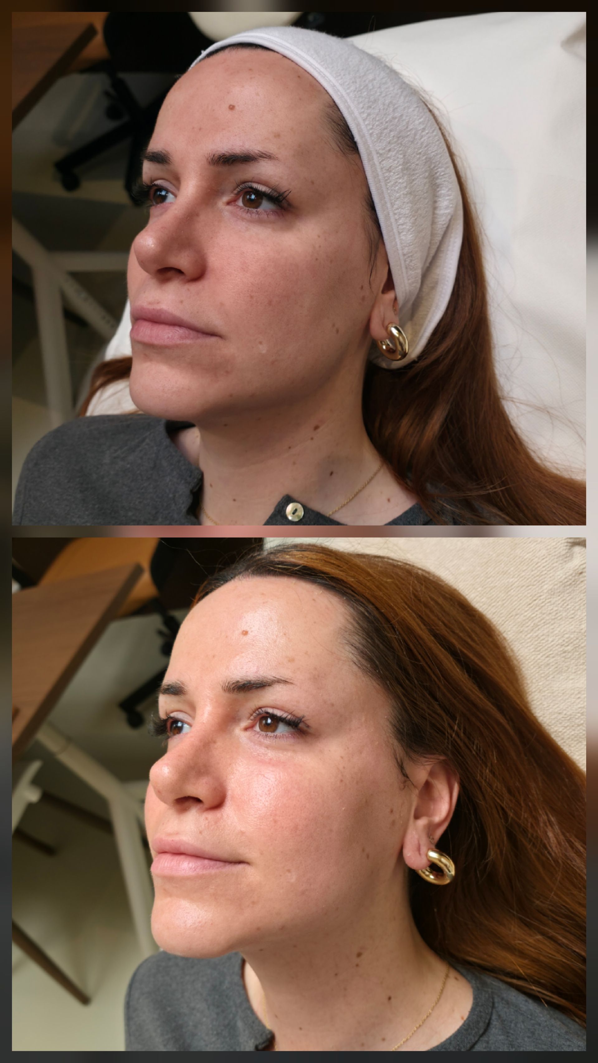 Premium clinic skin treatment result