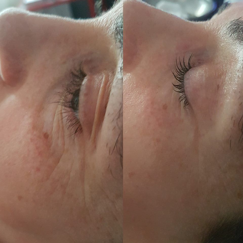 Complete Rejuvenation Before and After 2