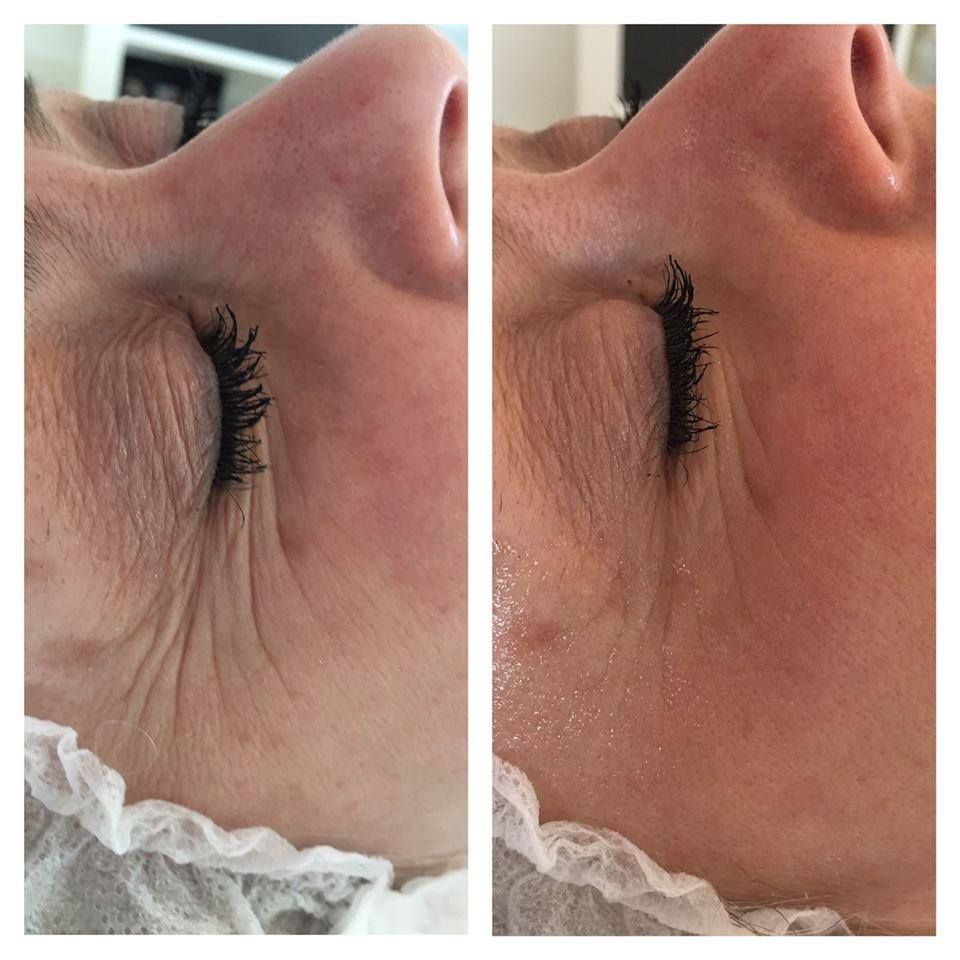 Complete Rejuvenation Before and After